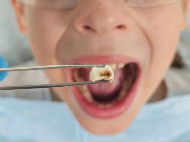 Best Walk-In Emergency Dental Services in Cotati, CA