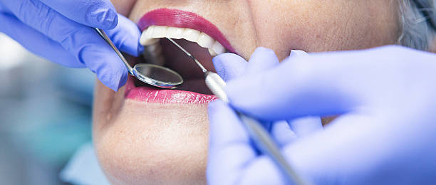 Trusted CA Emergency Dental Service Experts