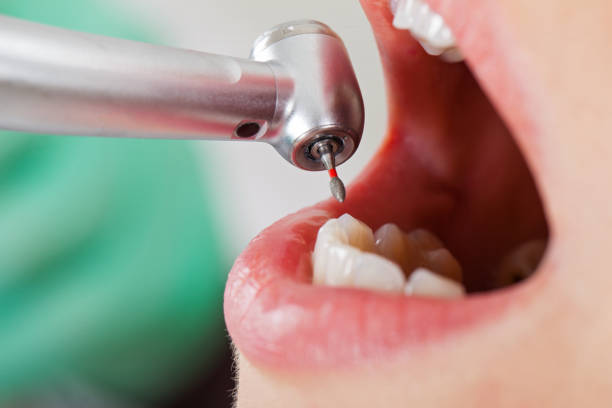 Best Emergency Dental Care for Sports Injuries in Cotati, CA